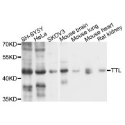 Western blot analysis of extracts of various cell lines, using TTL antibody (abx135945) at 1/1000 dilution.