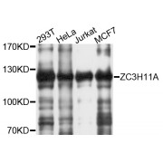 Western blot analysis of extracts of various cell lines, using ZC3H11A antibody (abx135962) at 1/1000 dilution.