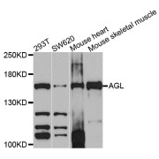 Western blot analysis of extracts of various cell lines, using AGL antibody (abx135969) at 1/1000 dilution.