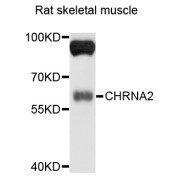 Western blot analysis of extracts of rat skeletal muscle, using CHRNA2 antibody (abx135974) at 1/1000 dilution.