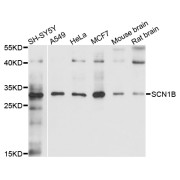 Western blot analysis of extracts of various cell lines, using SCN1B antibody (abx135989) at 1/1000 dilution.