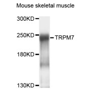 Western blot analysis of extracts of mouse skeletal muscle, using TRPM7 antibody (abx135993) at 1/1000 dilution.