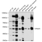 Western blot analysis of extracts of various cell lines, using IFNLR1 antibody (1/1000 dilution).