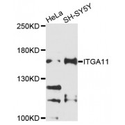 Western blot analysis of extracts of various cell lines, using ITGA11 antibody (abx136002) at 1/1000 dilution.