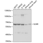 Western blot analysis of extracts of MCF7, SW620, K-562 cell lysates, Mouse lung and heart tissues (25 µg per lane), using Interleukin-1 Receptor-Like 2 (IL1RL2) Antibody (1/1000 dilution), followed by <a href="https://www.abbexa.com/index.php?route=product/search&search=abx005548" target="_blank">abx005548</a> - Goat Anti-Rabbit IgG, H+L (1/10000 dilution) and 3% non-fat dry milk in TBST for blocking.