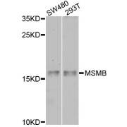 Western blot analysis of extracts of various cell lines, using MSMB antibody (abx136010) at 1/1000 dilution.