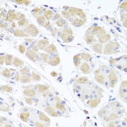 Beta-Microseminoprotein (MSMB) Antibody