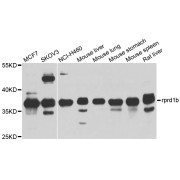 Western blot analysis of extracts of various cell lines, using rprd1b antibody (abx136012) at 1/1000 dilution.