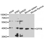 Western blot analysis of extracts of various cell lines, using DFFB antibody (abx136020) at 1/1000 dilution.