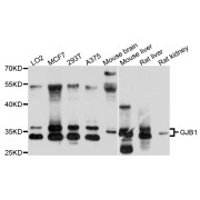 Western blot analysis of extracts of various cell lines, using GJB1 antibody (abx136022) at 1/1000 dilution.