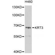 Western blot analysis of extracts of H460 cells, using KRT3 Antibody (abx136028) at 1/1000 dilution.