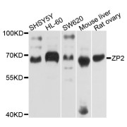 Western blot analysis of extracts of various cell lines, using ZP2 antibody (abx136036) at 1/1000 dilution.