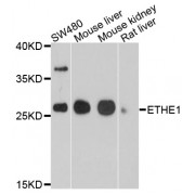 Western blot analysis of extracts of various cell lines, using ETHE1 antibody (abx136052) at 1/1000 dilution.