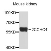 Western blot analysis of extracts of mouse kidney, using ZCCHC4 antibody (abx136054) at 1/1000 dilution.