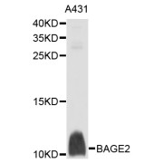 Western blot analysis of extracts of A-431 cells, using BAGE2 antibody (abx136069) at 1/1000 dilution.