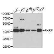 Western blot analysis of extracts of various cell lines, using FKRP antibody (abx136090) at 1/1000 dilution.