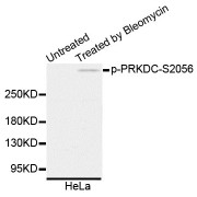 Western blot analysis of extracts of HeLa cells, using Phospho-PRKDC-S2056 antibody (abx136146).