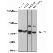 Western blot analysis of extracts of various cell lines, using SLC2A2 antibody (1/3000 dilution).