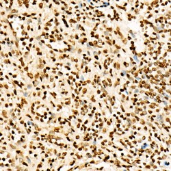 Histone H3K27AC Antibody
