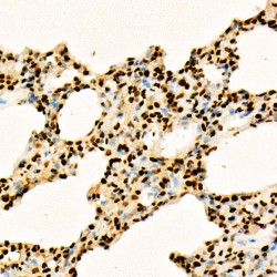 Histone H3K27AC Antibody