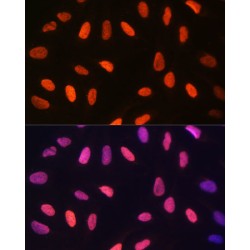 Trimethyl-Histone H3-K14 Antibody