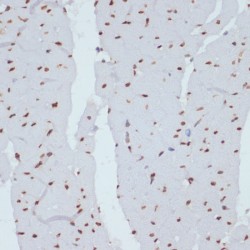 CHEK1 (pS280) Antibody