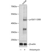 Western blot analysis of lysates from Jurkat cells, using Phospho-ELK1-S383 Antibody at 1/1000 dilution. Jurkat cells were treated by Anisomycin (5 µg/ml) for 30 minutes after serum-starvation overnight. Secondary antibody: HRP-conjugated Goat anti-Rabbit IgG (H+L) at 1/10000 dilution. Lysates/proteins: 25 µg per lane. Blocking buffer: 3% BSA. Exposure time: 10s.