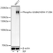 Western blot analysis of lysates from MCF7 cells using Phospho-ErbB4/HER4-Y1284 Antibody at 1/700 dilution. MCF7 cells were treated by IGF (200 ng/ml) at 37 °C for 30 minutes after serum-starvation overnight. Secondary antibody: HRP-conjugated Goat anti-Rabbit IgG (H+L) at 1/10000 dilution. Lysates/proteins: 20 µg per lane. Blocking buffer: 3% nonfat dry milk in TBST. Exposure time: 30s.