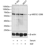 Western blot analysis of lysates from K-562 and MCF-7 cells, using Phospho-MEF2C-S396 Antibody at 1/1000 dilution. K562 cells were treated by 10% FBS for 30 minutes after serum-starvation overnight. MCF7 cells were treated by EGF (100ng/ml) for 30 minutes after serum-starvation overnight. Secondary antibody: HRP-conjugated Goat anti-Rabbit IgG (H+L) at 1/10000 dilution. Lysates/proteins: 25 µg per lane. Blocking buffer: 3% BSA.