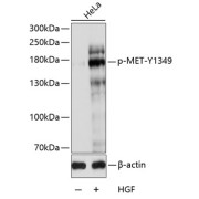 Western blot analysis of lysates from HeLa cells, using Phospho-MET-Y1349 Antibody at 1/1000 dilution. HeLa cells were treated by HGF (40ng/ml) for 10 minutes after serum-starvation overnight. Secondary antibody: HRP-conjugated Goat anti-Rabbit IgG (H+L) at 1/10000 dilution. Lysates/proteins: 25 µg per lane. Blocking buffer: 3% BSA. Exposure time: 90s.