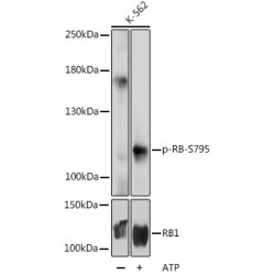 Retinoblastoma Protein 1 Phospho-Ser795 (RB1 pS795) Antibody