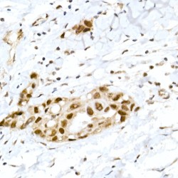 Retinoblastoma Protein 1 Phospho-Ser795 (RB1 pS795) Antibody