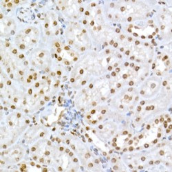 Retinoblastoma Protein 1 Phospho-Ser795 (RB1 pS795) Antibody