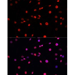 HIST1H3B (pT12) Antibody