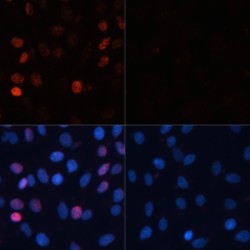 Histone H2A.x (pS139) Antibody