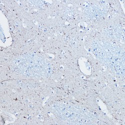 Microtubule-Associated Protein Tau Phospho-Ser396 (MAPT pS396) Antibody
