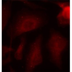 Microtubule-Associated Protein Tau Phospho-Ser404 (MAPT pS404) Antibody