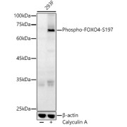 Western blot analysis of various lysates, using Phospho-FOXO4-S197 Antibody at 1/400 dilution. Secondary antibody: HRP-conjugated Goat anti-Rabbit IgG (H+L) at 1/10000 dilution. Lysates/proteins: 25 µg per lane. Blocking buffer: 3% nonfat dry milk in TBST. Exposure time: 60s.