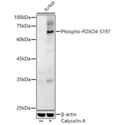 FOXO4 (pS197) Antibody