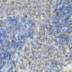 Vasodilator Stimulated Phosphoprotein Phospho-Ser239 (VASP pS239) Antibody