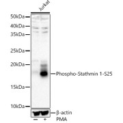 Western blot analysis of various lysates, using Phospho-Stathmin 1-S25 Antibody at 1/400 dilution. Secondary antibody: HRP-conjugated Goat anti-Rabbit IgG (H+L) at 1/10000 dilution. Lysates/proteins: 25 µg per lane. Blocking buffer: 3% nonfat dry milk in TBST. Exposure time: 60s.