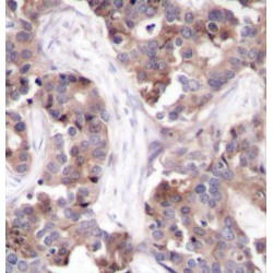 Stathmin 1 Phospho-Ser25 (STMN1 pS25) Antibody