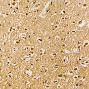 Immunohistochemistry analysis of paraffin-embedded Human brain using Phospho-Akt-Y315 Antibody at dilution of 1/100 (40x lens). High pressure antigen retrieval performed in 0.01 M Citrate buffer (pH 6.0) prior to IHC staining.