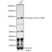 Western blot analysis of lysates from HeLa cells, using Phospho-STAT2-Y690 Antibody at 1/500 dilution.HeLa cells were treated by IFN-α (100 ng/ml) at 37 °C for 30 minutes after serum-starvation overnight. Secondary antibody: HRP-conjugated Goat anti-Rabbit IgG (H+L) at 1/10000 dilution. Lysates/proteins: 25 µg per lane. Blocking buffer: 3% nonfat dry milk in TBST. Exposure time: 60s.