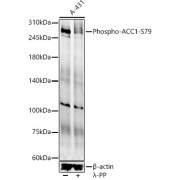 Western blot analysis of lysates from A-431 cells, using Phospho-ACC1-S79 Antibody at 1/700 dilution. A-431 cells were treated by λ-PP mixed solution (1ul) at 30 °C for 30 minutes. Secondary antibody: HRP-conjugated Goat anti-Rabbit IgG (H+L) at 1/10000 dilution. Lysates/proteins: 25 µg per lane. Blocking buffer: 3% nonfat dry milk in TBST. Exposure time: 90s.