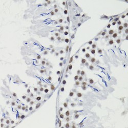 BCL2 (pT56) Antibody