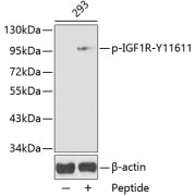 Western blot analysis of lysates from 293 cells, using Phospho-IGF1R-Y1161 Antibody. Secondary antibody: HRP-conjugated Goat anti-Rabbit IgG (H+L) at 1/10000 dilution. Lysates/proteins: 25 µg per lane. Blocking buffer: 3% BSA.