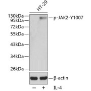 Western blot analysis of lysates from HT29 cells using Phospho-JAK2-Y1007 Antibody. Secondary antibody: HRP-conjugated Goat anti-Rabbit IgG (H+L) at 1/10000 dilution. Lysates/proteins: 25 µg per lane. Blocking buffer: 3% BSA.