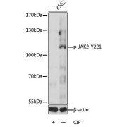 Western blot analysis of lysates from K562 cells, using Phospho-JAK2-Y221 Antibody at 1/1000 dilution. K562 cells were treated by CIP (20 µl CIP for each 400 µl cell lysate) at 37 °C for 1 hour. Secondary antibody: HRP-conjugated Goat anti-Rabbit IgG (H+L) at 1/10000 dilution. Lysates/proteins: 25 µg per lane. Blocking buffer: 3% BSA. Exposure time: 30s.