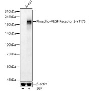 abx000430